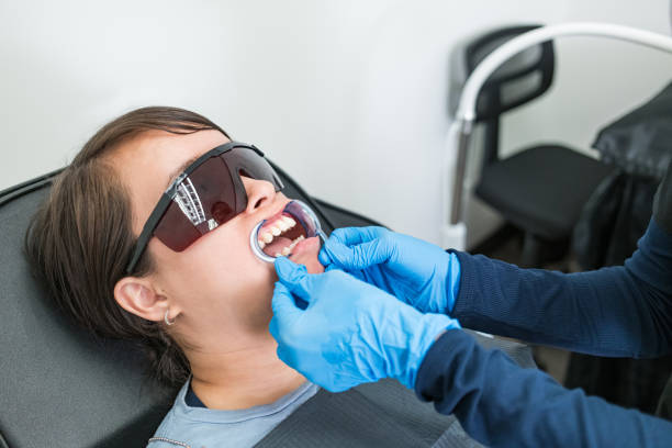 Best Knocked-Out Tooth (Avulsed Tooth) Treatment in Bennettsville, SC